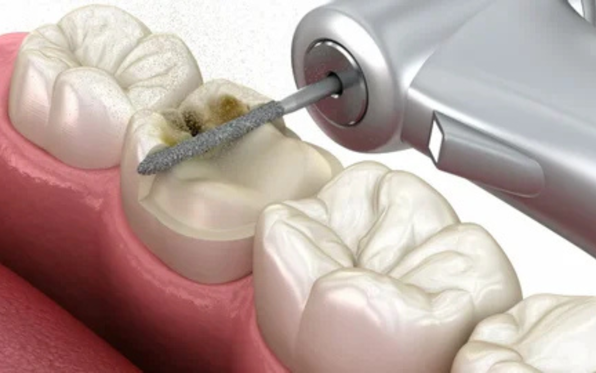 Image hover effect image