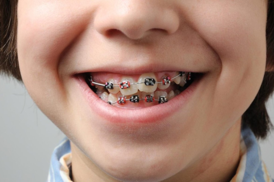 Untitled-design-36-qyhkmpci9zz5z5zfvbl58s7l9q816lagmwija2p1iq