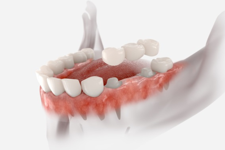 Untitled-design-46-qyhn8ylvlx0a7h2jh2cc9zxlqpn31xhgxfldqyxtki