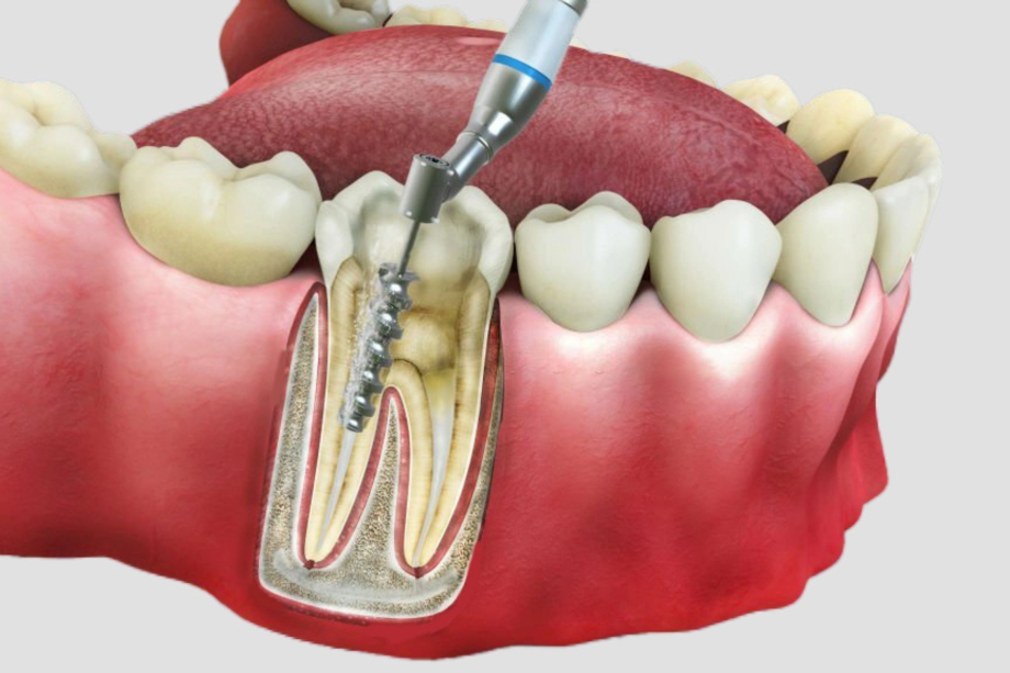 Untitled design(380)